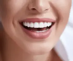 Benefits of Composite Bonding