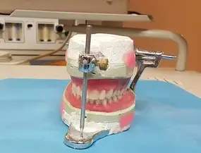 Dentures