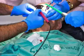 Root Canal Treatment