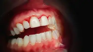  What Is Periodontics and Why Is It Important?