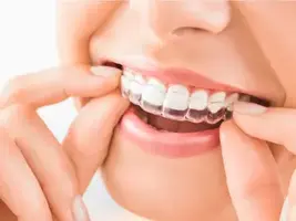 Why Are Retainers Important?